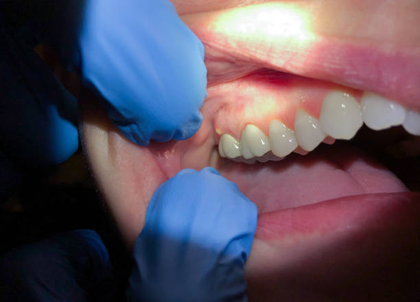Best Emergency Treatment for Toothache in Newman, CA